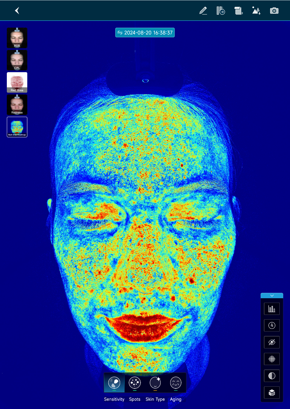 Analysis of sensitive symptoms now includes