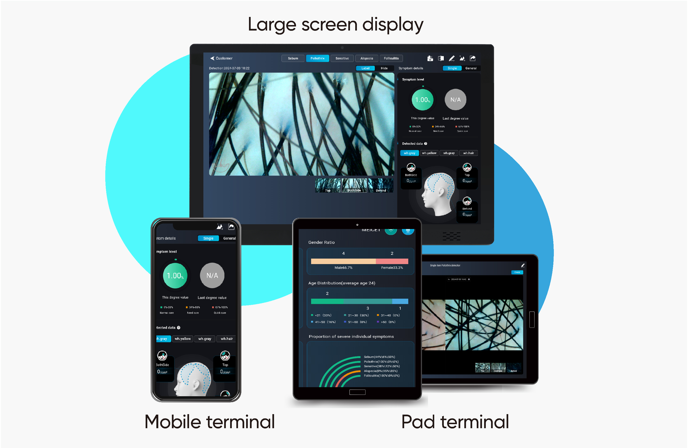 Smart APP  ·  Multiterminal viewing