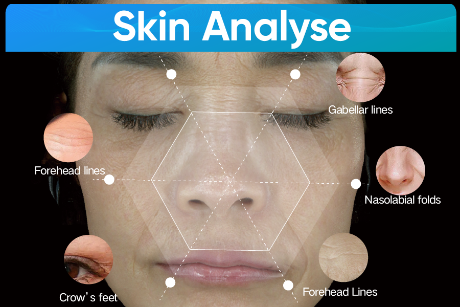 Innovative technology empowers the beauty industry: Exploring the revolutionary changes of Meicet skin analyzer