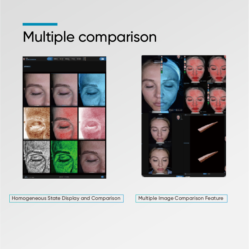 S7  Skin Analyzer  (7)