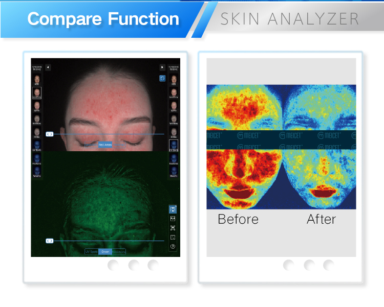 Skin Analyzer MC88 (6)