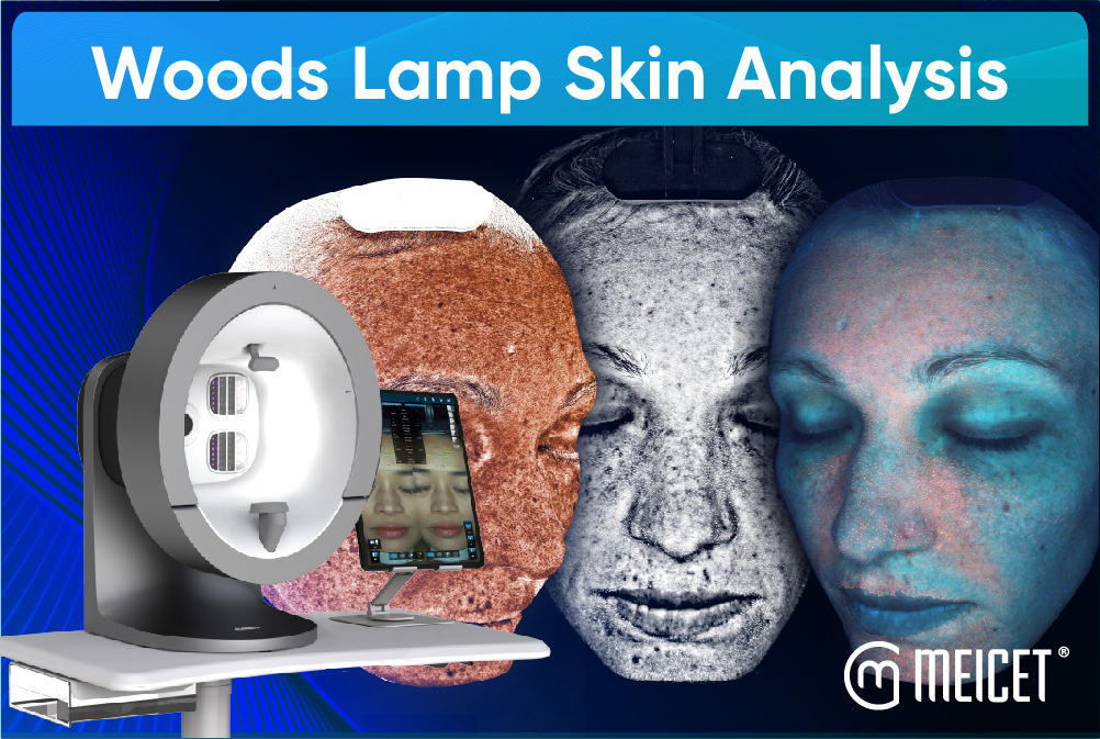 What’s  The Role of Woods Lamp Skin Analysis for Distributors？