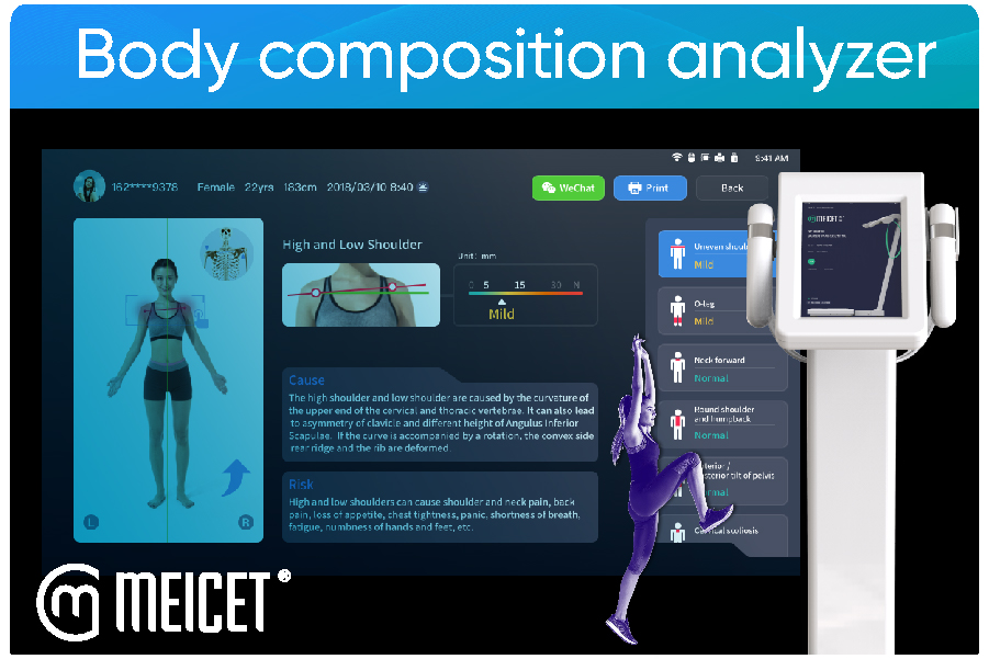 The Role of Body Composition Analyzers in Fitness