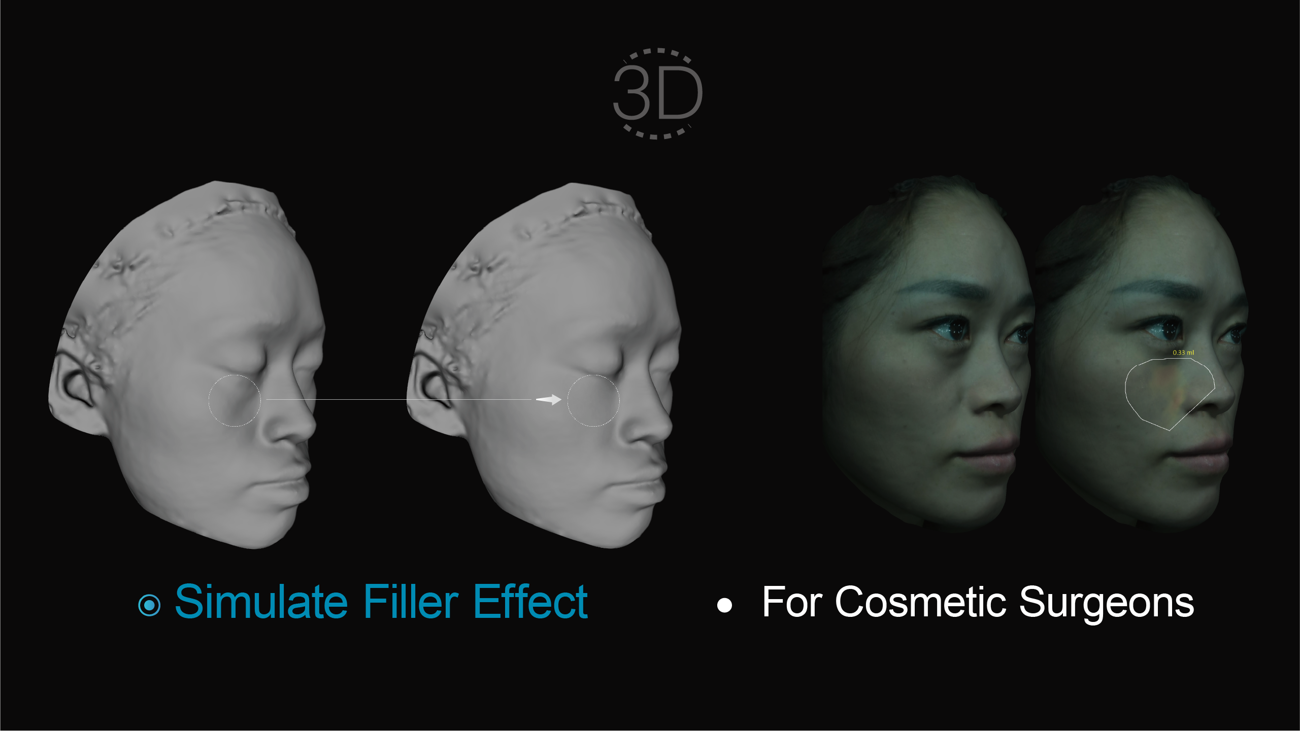 3D Aesthetic Function（Simulate Filler Effect）  